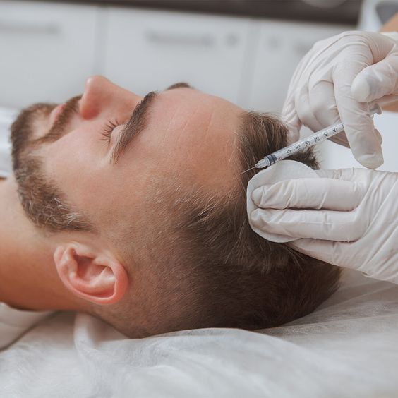 Hair Restoration | Thrive Medical Spa: A True Medical Spa Milton, GA